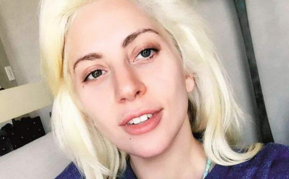 ladygaga罕见素颜照曝光,自称精神有问题,网友:又一个傻脸娜?