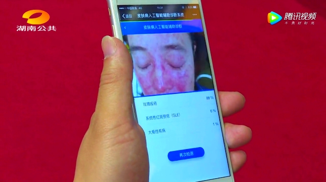 皮肤病拍照自测app图片