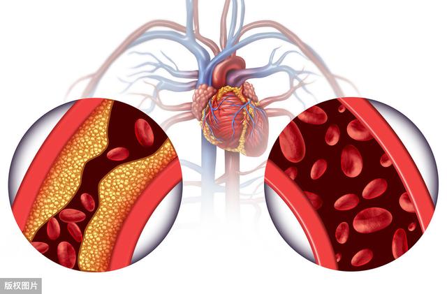 为什么阿司匹林可以治疗血管炎症?可能与线粒体异常有关