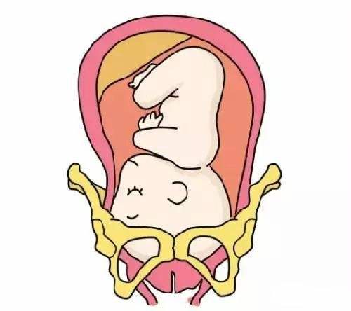 胎儿入盆图片肚型图片