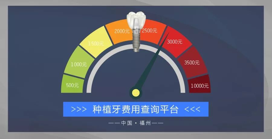 种牙价格大概多少钱一颗