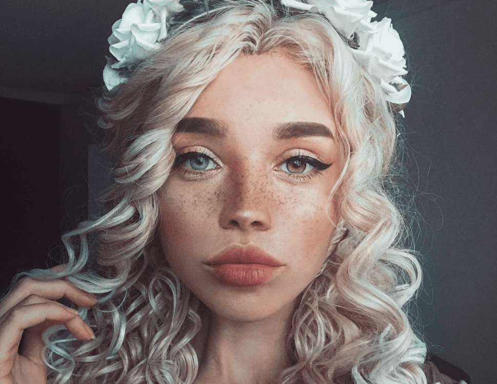 前所未见的美丽!16位「拥有独一无二外表」的罕见天使