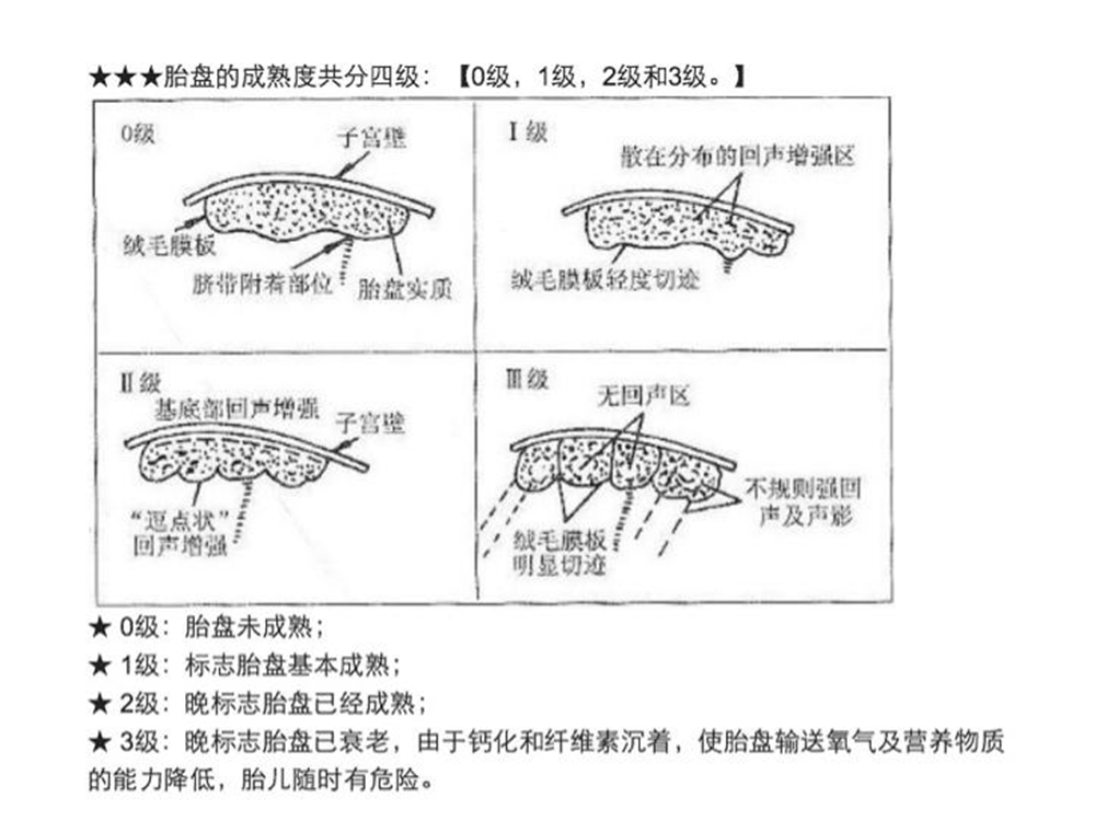 胎儿是否发动,不在于"胎盘成熟度",准妈妈们别抓错"重点"