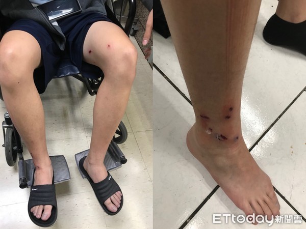 新手警察日常训练完擦枪不慎 枪支走火弹头碎片伤及同事