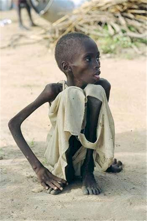 世界欠摄影师一句道歉:照片中饿得只剩皮包骨的女孩,活下来了吗