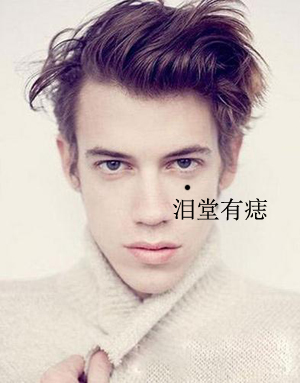 细数男人脸上几处克妻痣,最好点去