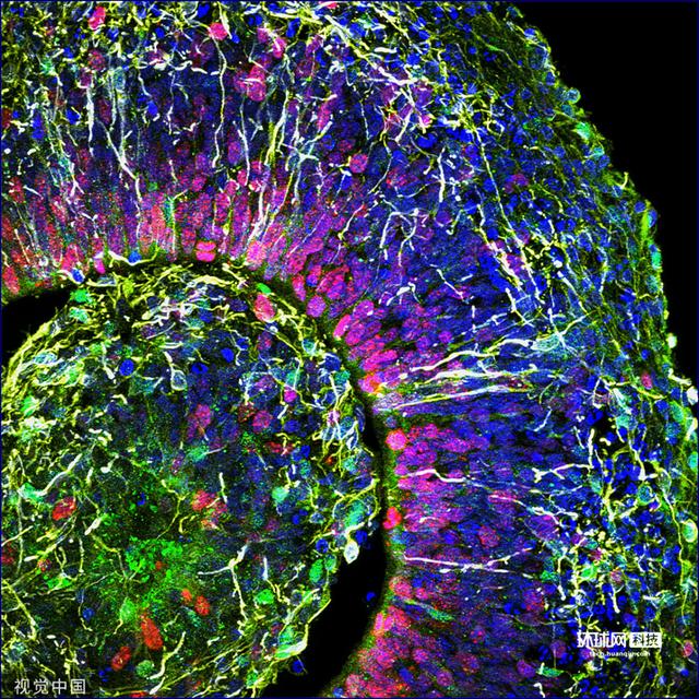 科学家首次在实验室培育的"微型大脑'中检测到电活动