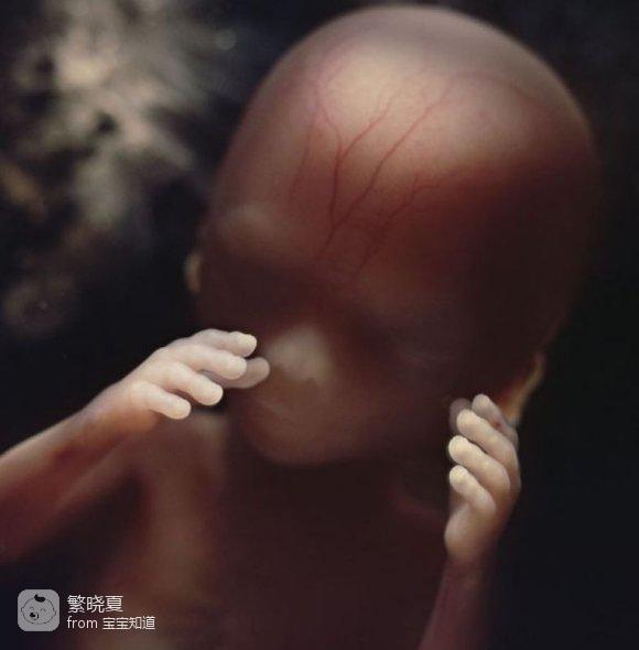 4个月胎儿图片 男孩图片