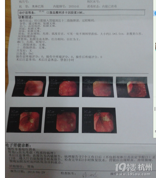 听一名孝顺女儿讲述爸爸的求医之路(胃角腺癌)