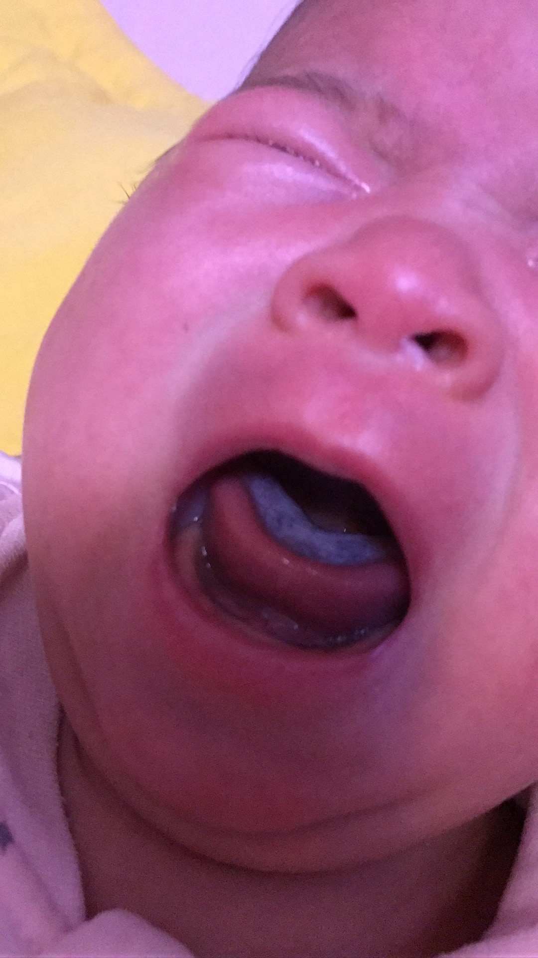 宝宝舌头上有白苔图片图片