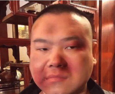 岳云鹏被打成"猪头",惹人心疼,是因为有人带他面具抢劫?