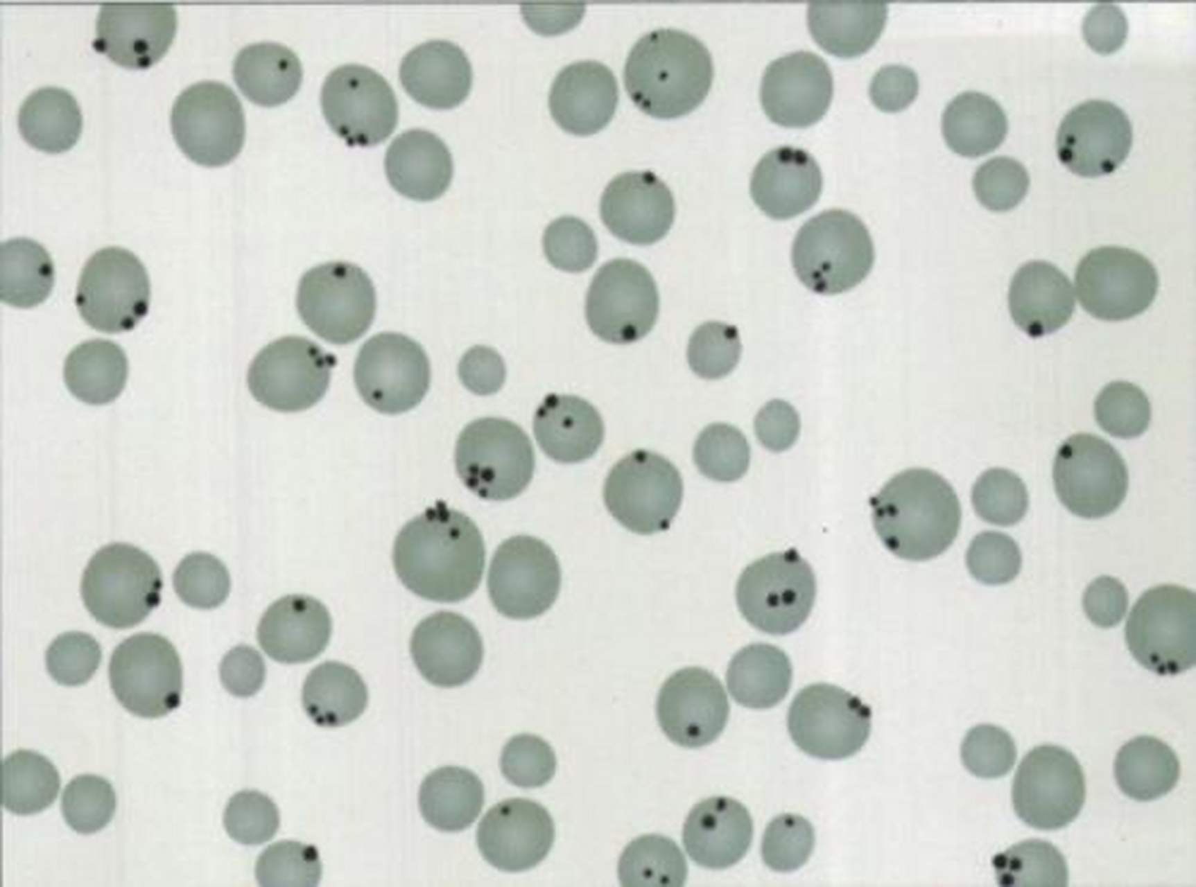 科普知识竞赛#变性珠蛋白小体检测(heinz小体)是一种变性血红蛋鬃