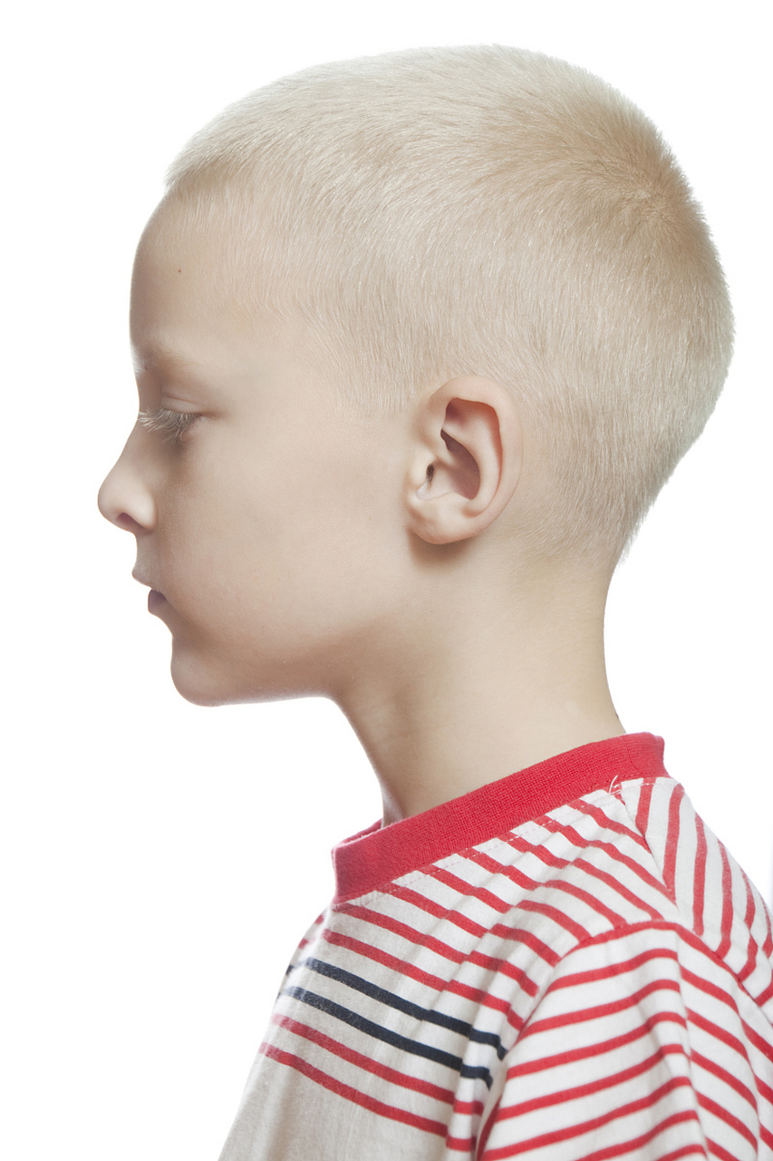 婴儿总往一边睡,头睡偏了怎么办?