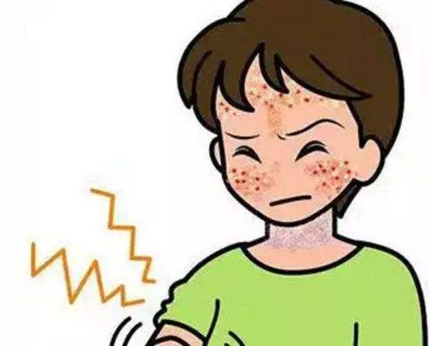 神经过敏 baijiahao.baidu.com
