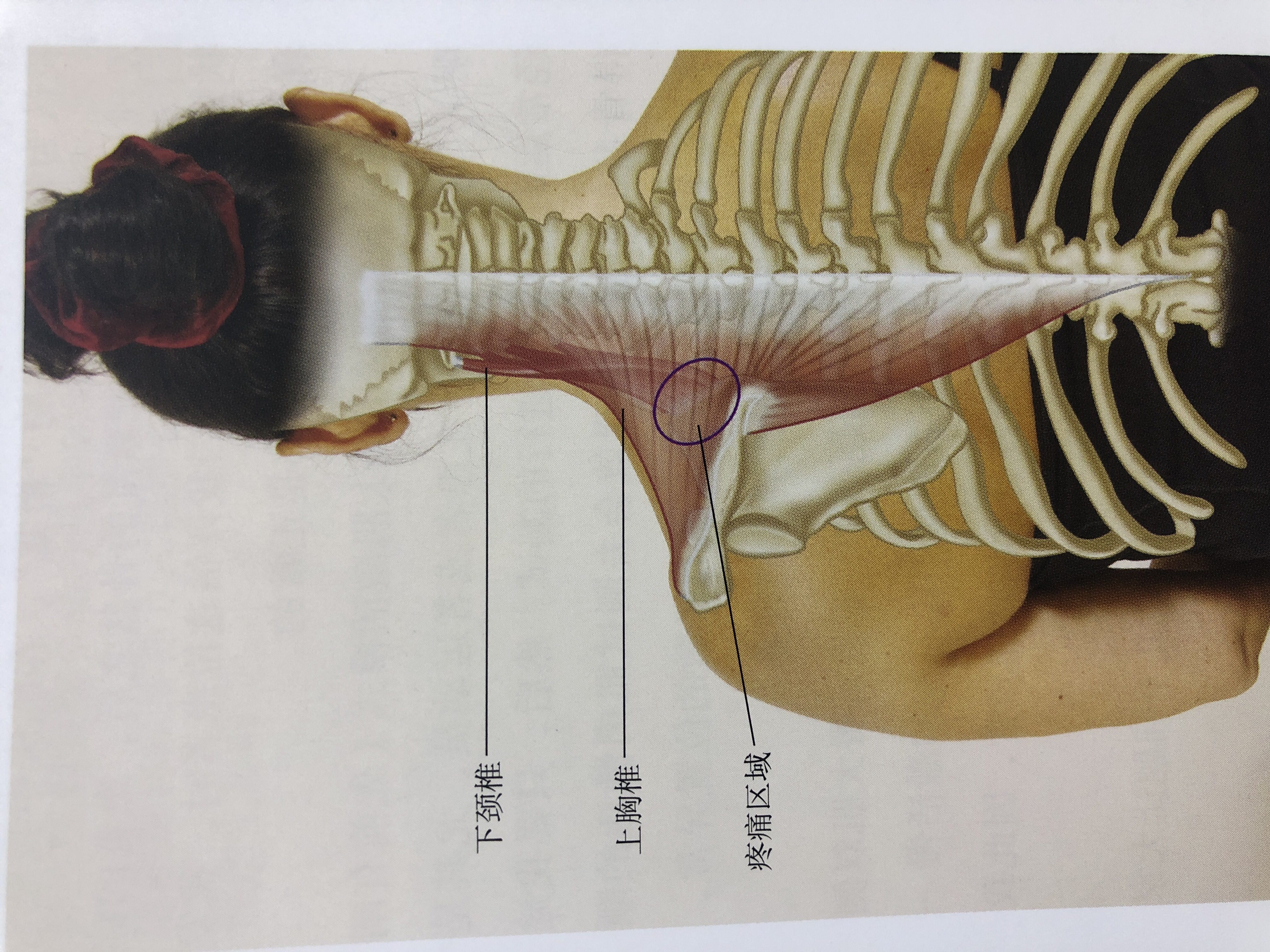 肩胛骨图片位置示意图图片