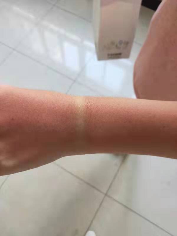 泡在水里更容易被晒伤!医院收治多起因游泳晒伤患者