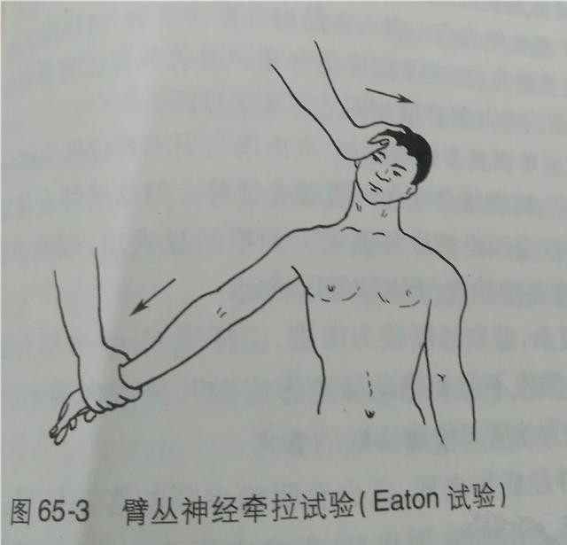 eaton试验图片