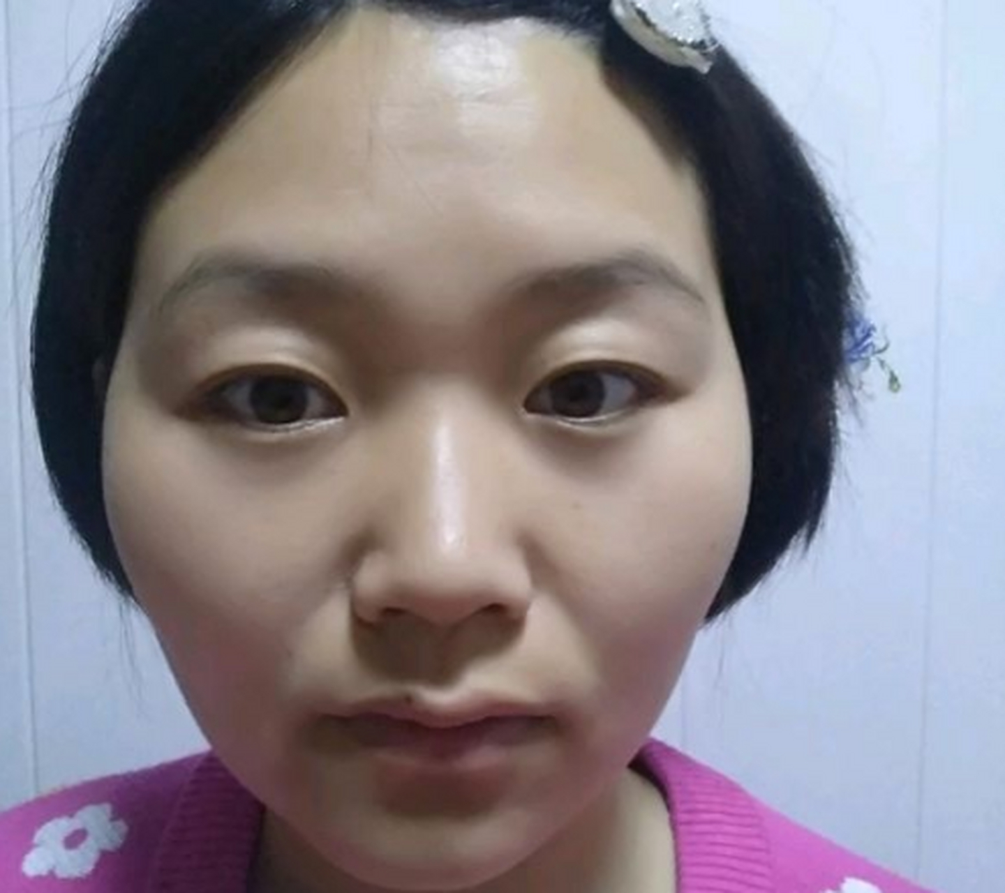 面相额头低窄 田宅宫凹陷的家庭条件不是很好,这种面相白手起家的人