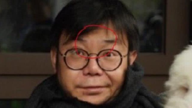 沱沱曾否认家暴,家暴男到底有多可怕?看看宇芽的状态就知道了!