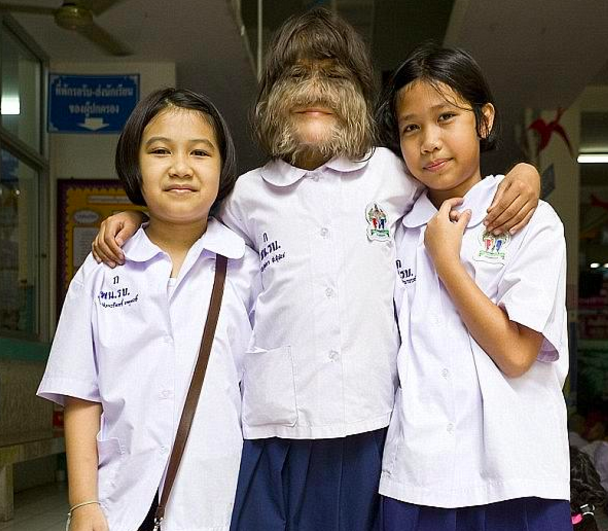 这是她和老公的合影,真正无毛的状态,还可以接受吗?