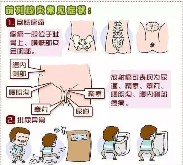 前列腺炎有什么症状男图片