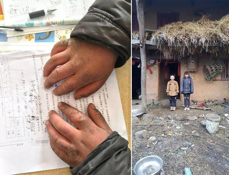 冰花男孩获捐30万仅得500?农村人骤得30万就是一夜暴富?