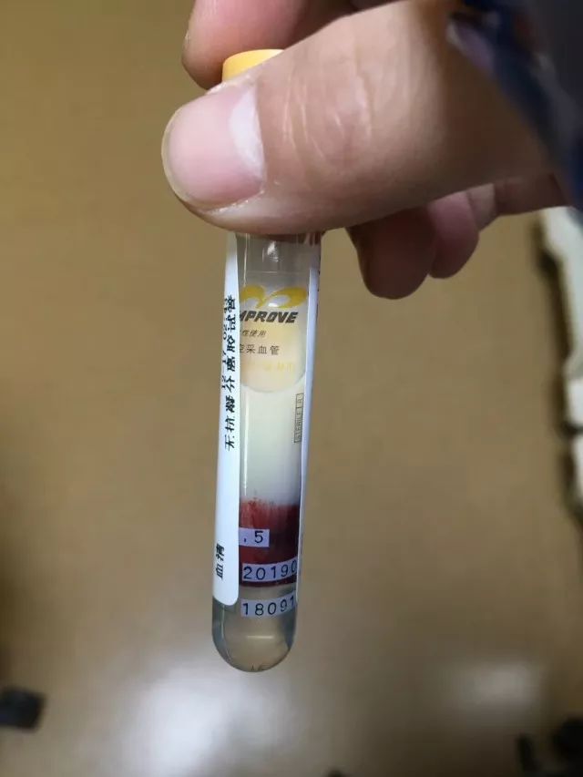 动脉血是什么颜色 baijiahao.baidu.com