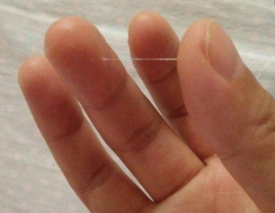 排卵期,出现"白带拉丝"是排卵前还是排卵后?多数女人想错了!