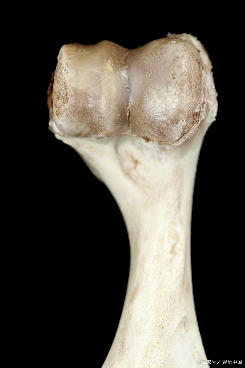 乳癌骨转移患者如何日常"护骨"? 1