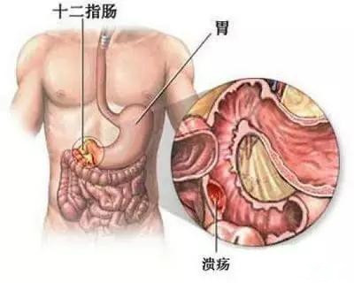胃区疼痛位置图不好图片
