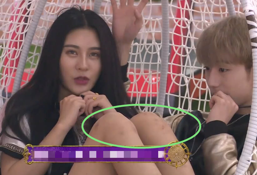 杨馥宇跳舞到底有多卖力?看到她青一块紫一块的膝盖后,网友傻眼