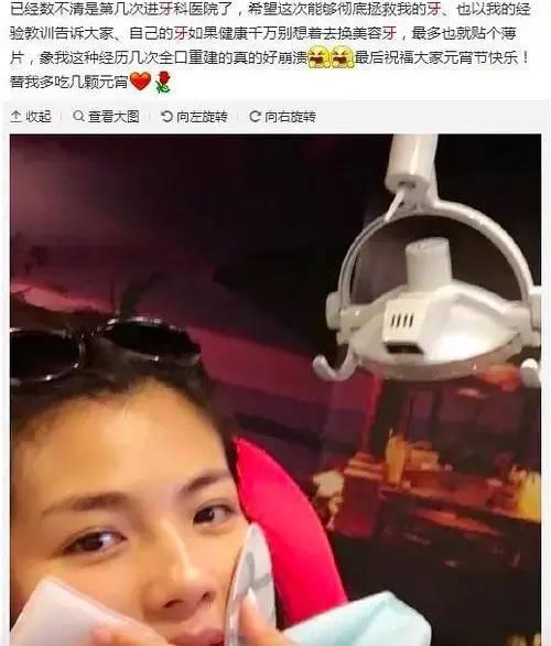 爱牙日|明星满口假牙,但刘涛为啥劝你不要为美而装烤瓷牙?