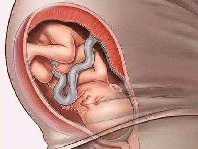 怀孕36周胎儿图片图片