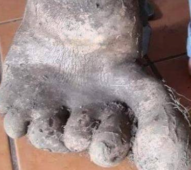 巴西农民夫妻种土豆,收货时发现巨型"人脚"