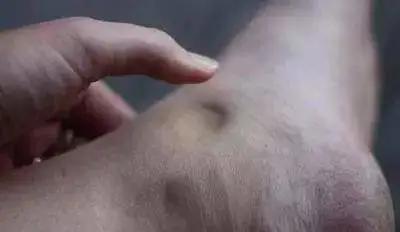 3个瑜伽体式消水肿,让你的身材小一号