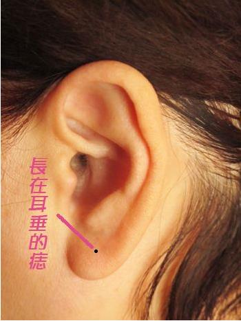 这三个地方有痣的女人,能旺夫旺婆家,千万别点掉