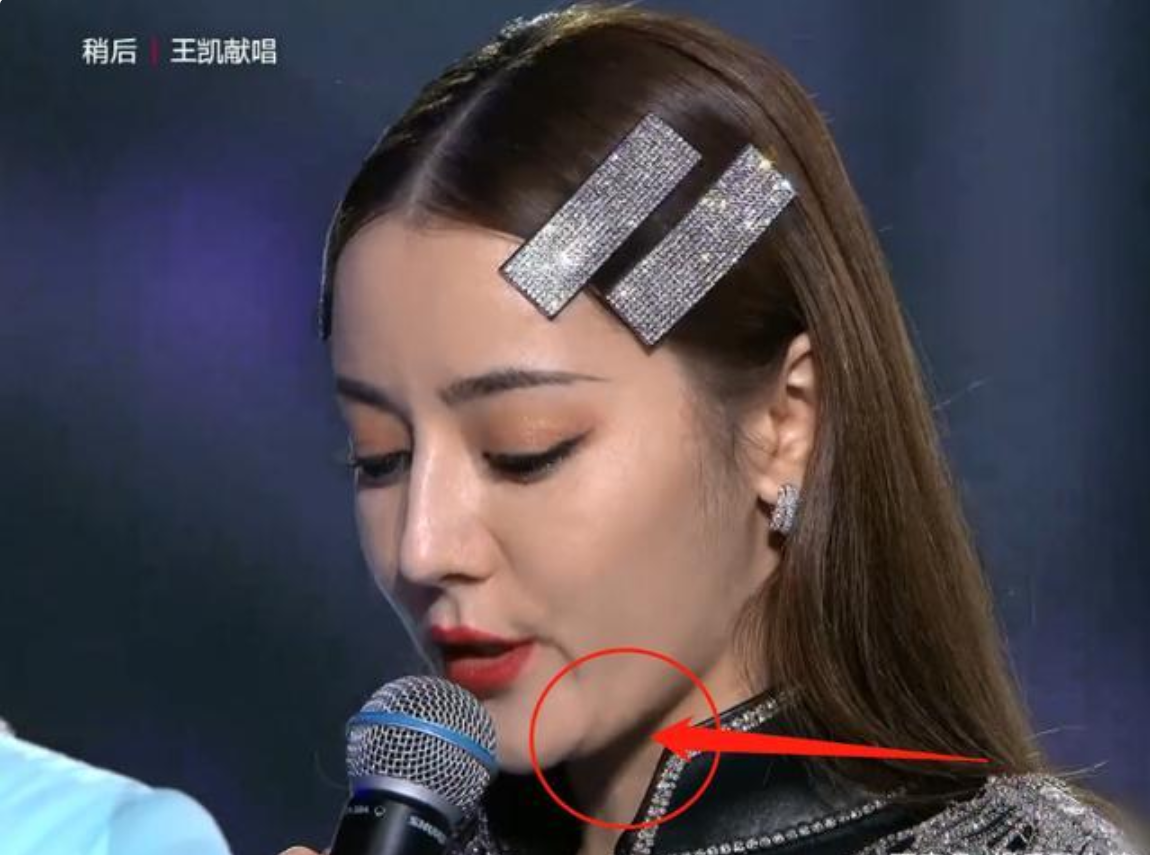 迪丽热巴跨年生图引网友热议:面似浮肿疑似双下巴,这还是她吗?