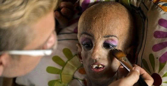 美国华盛顿"外星人小孩",爸妈痛哭流涕,医生诊断让世人不解