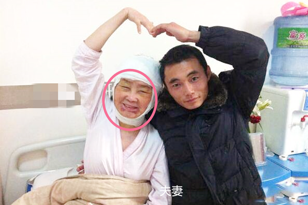 80后美女生娃后一夜变老太,28岁年纪80岁的皱纹脸,现状令人唏嘘