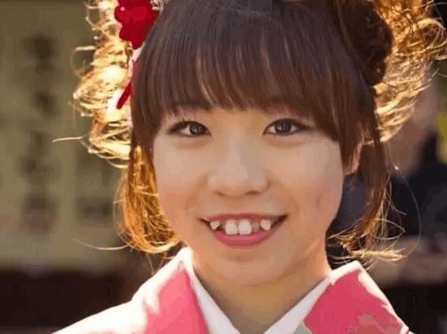 为什么日本妹子的牙齿都很丑?背后隐藏着这样的秘密!