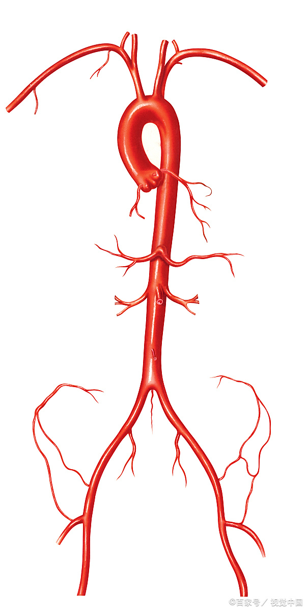 腹主动脉瘤:危害大还是可能被控制?详细解读及治疗方法!