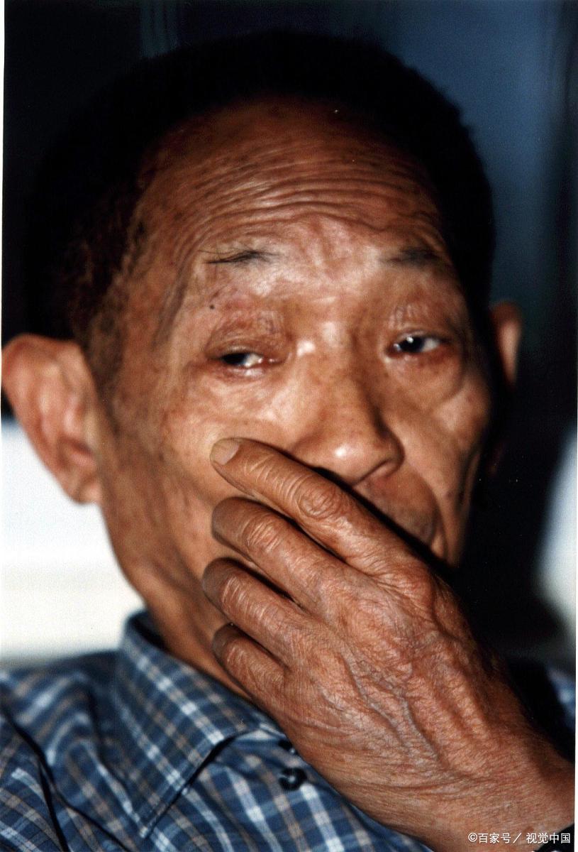 麻风病知多少#嘿,朋友们!