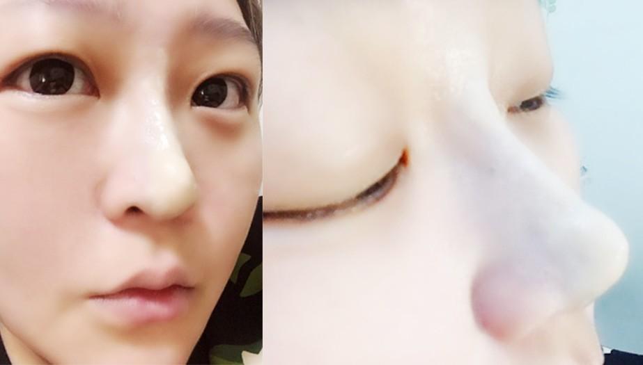 抖音同款假鼻子!网红超强无痛易容术一秒拥有高挑鼻!