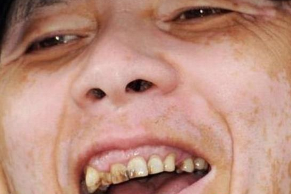 冯小刚旧照曝光,满口黄牙不忍直视,网友一句话却惹人泪目