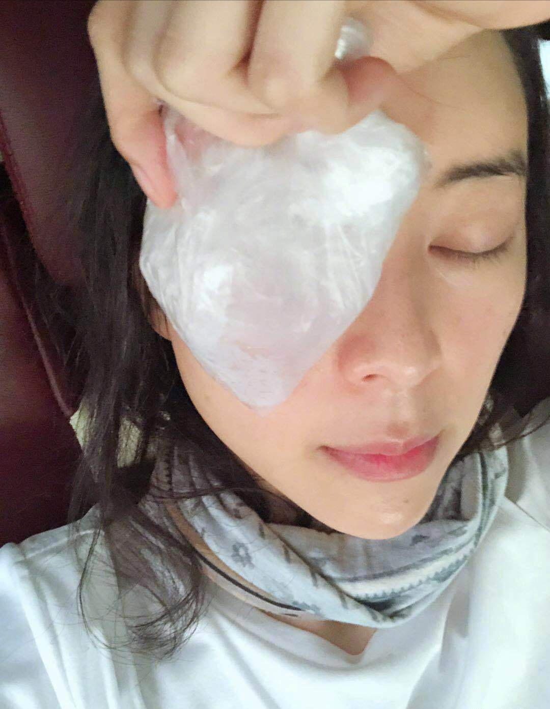 张静初为了眼睛消肿,依次采用网友意见,冰敷土豆片茶叶包热鸡蛋