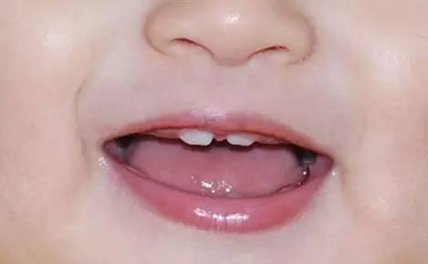 宝宝出牙晚跟缺钙有关吗?