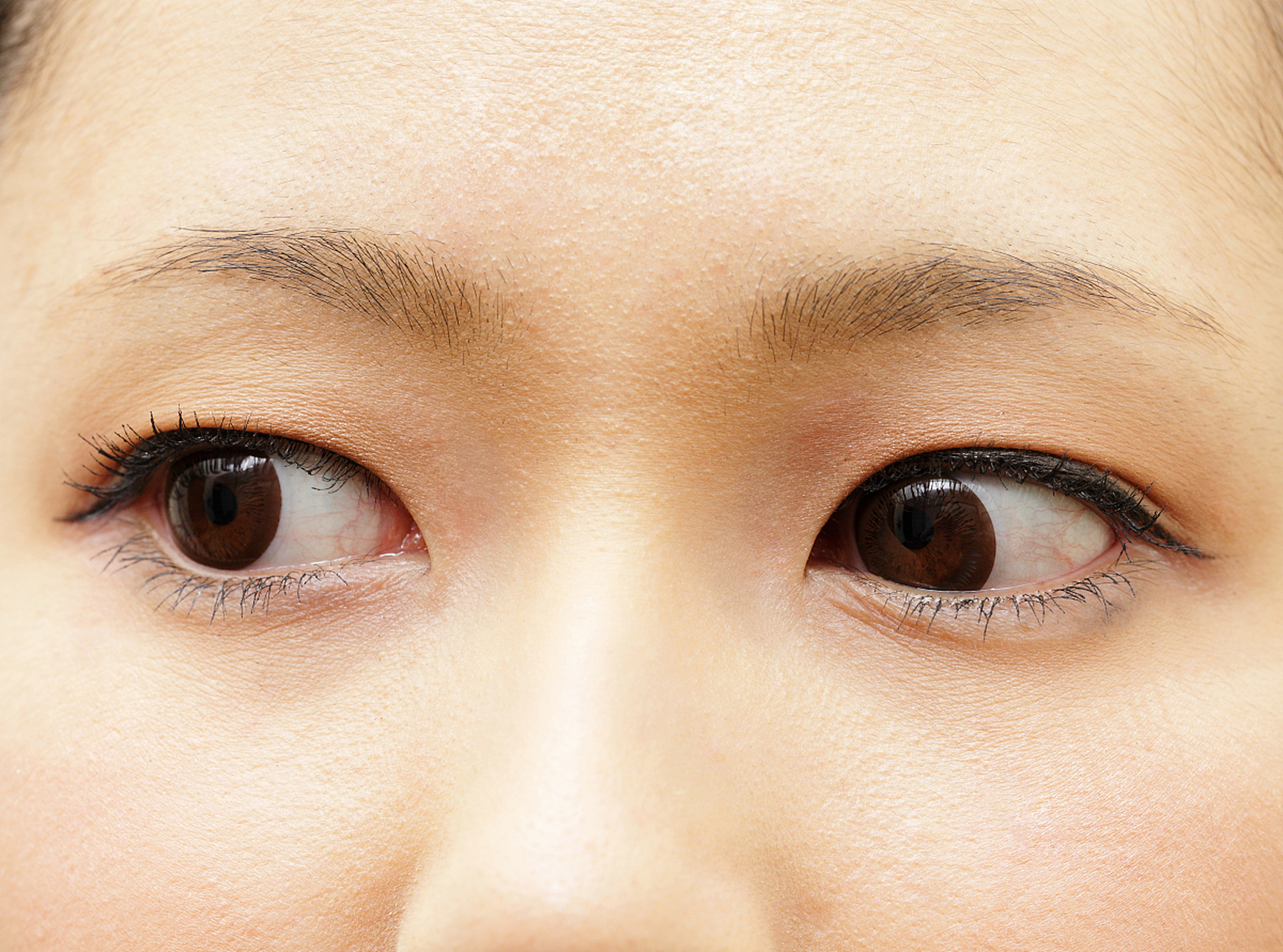 眼角下垂的眼型是一种常见的眼部形态,通常表现为眼角处向下弯曲,形成