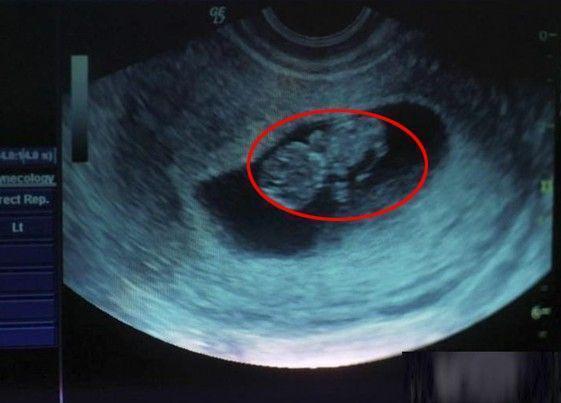 60天的胎儿图片图片