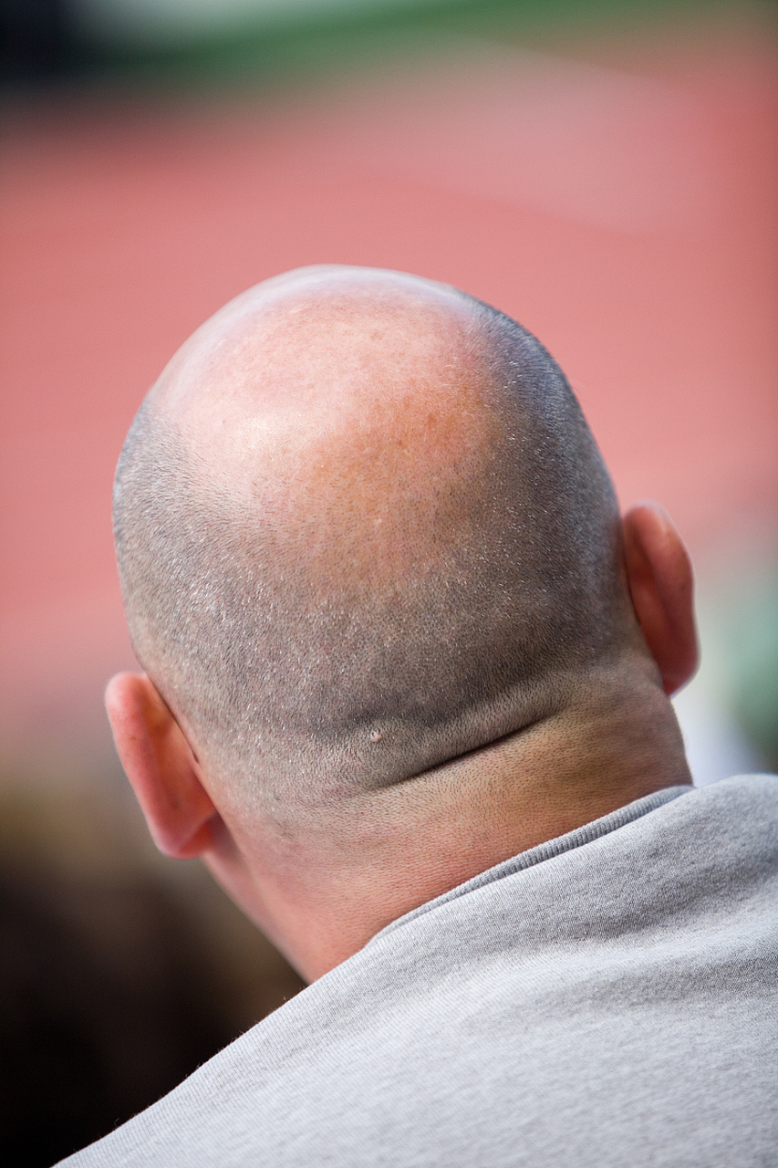 经常剃光头头发会变浓密吗?