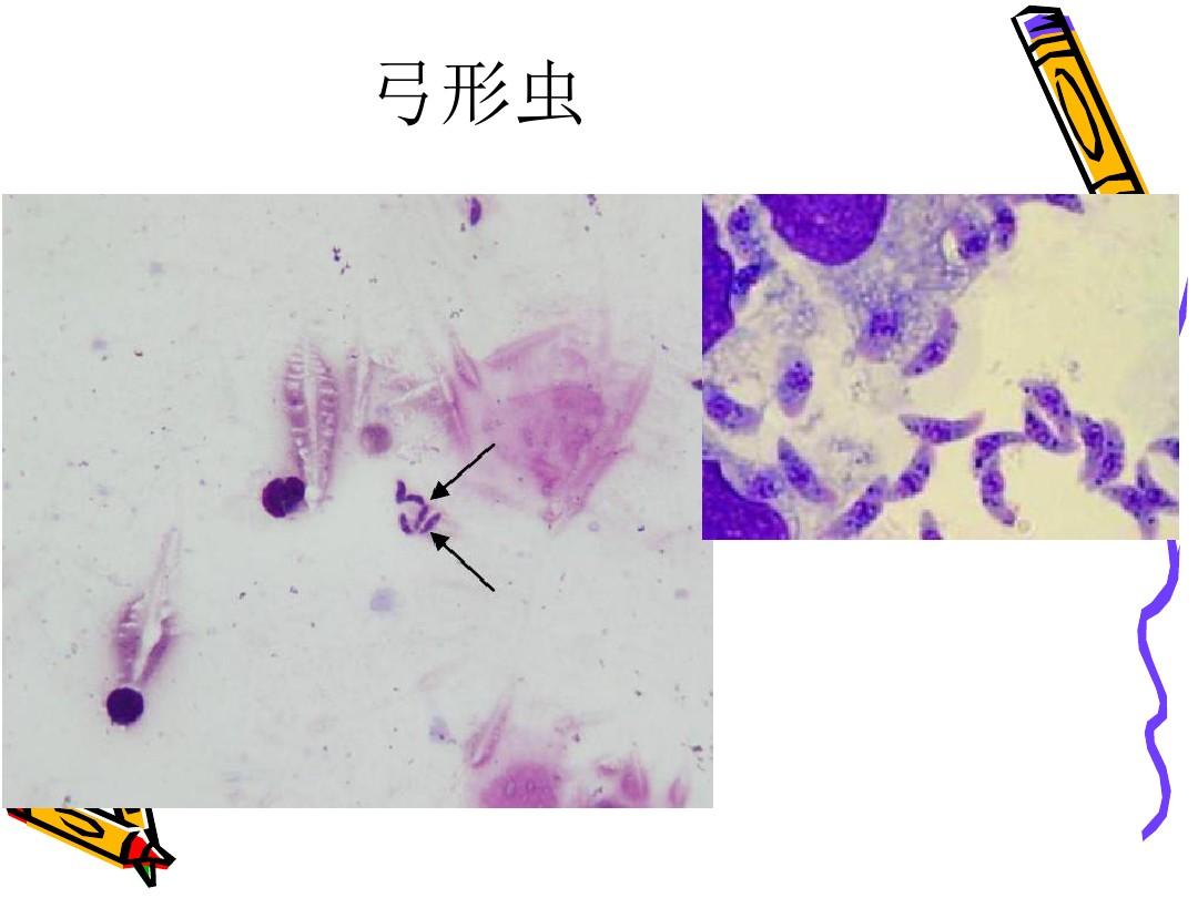 91种不同物种42%被感染"弓形虫病,对人类影响有多大?